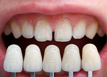4M Dental Implant Center