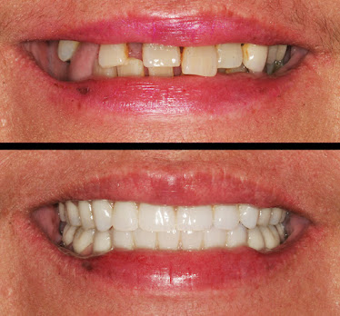 4M Dental Implant Center