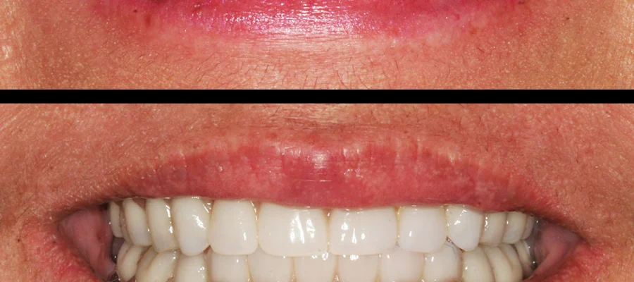 4M Dental Implant Center