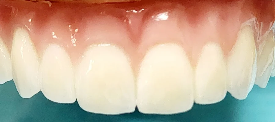 A To Z Dental
