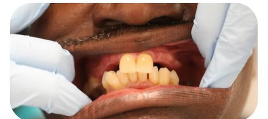 A1 Dental Services