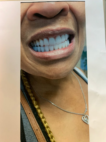 AApoLLo Dental Centers