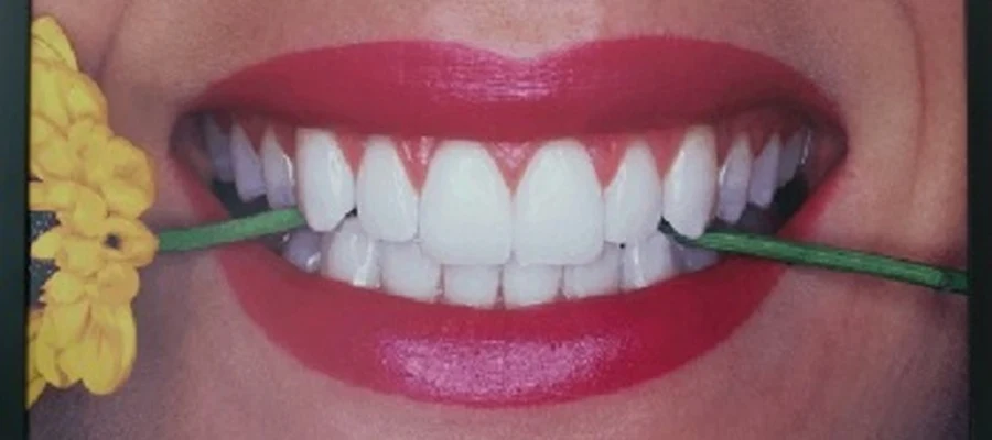 Advance Dental Care