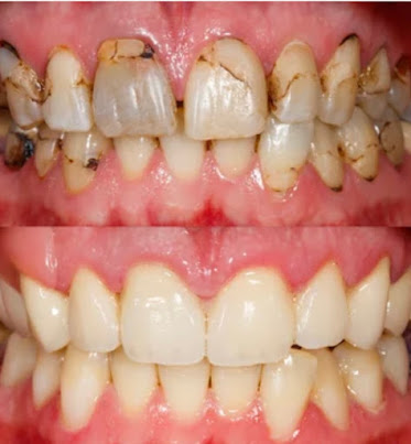 Advanced Dental Care Lakewood