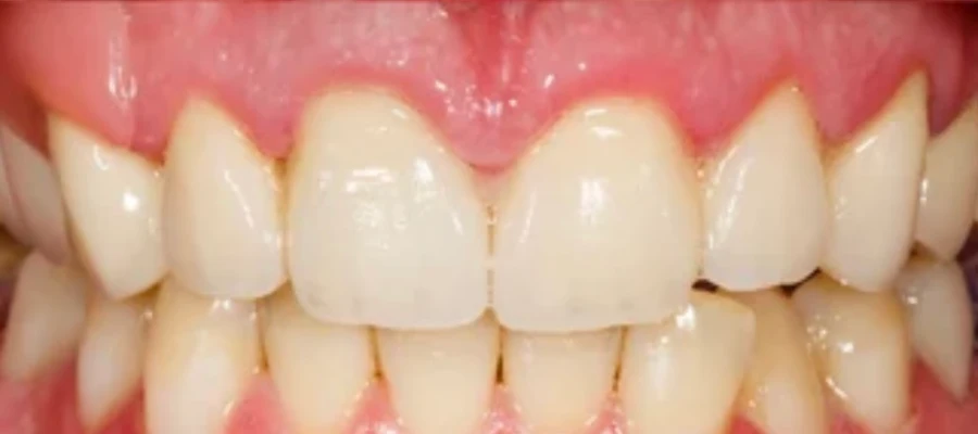 Advanced Dental Care Lakewood