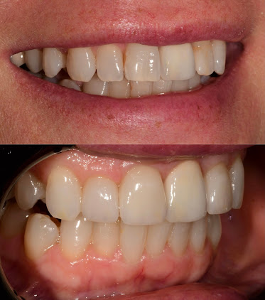 Advanced Dentistry By Soboh Liswi Tedini