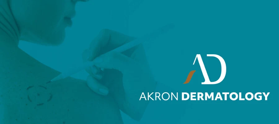 Akron Dermatology