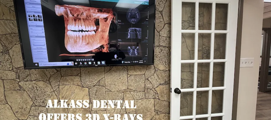 Alkass Dental