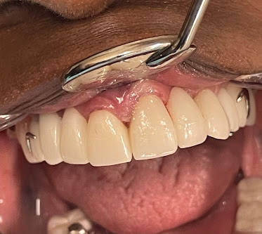 All Dental