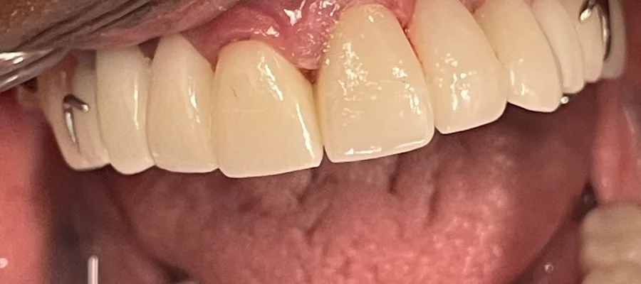 All Dental