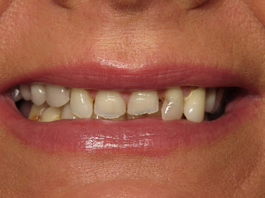 All-In-One Dental