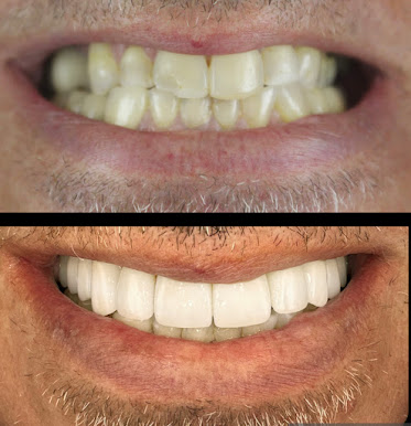 Allure Dental Chicago - Lincoln Park