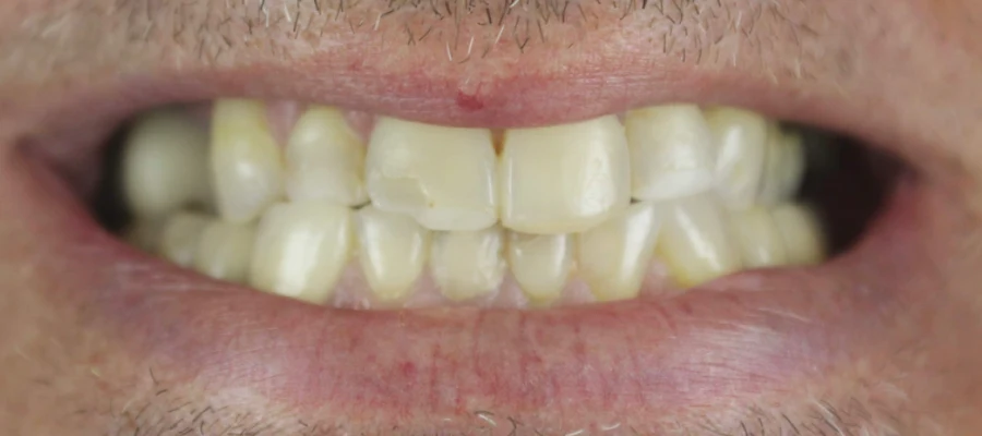 Allure Dental Chicago - Lincoln Park