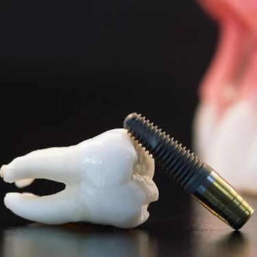 Almeida & Bell Dental Denver - General, Cosmetic, and Implant Dentistry