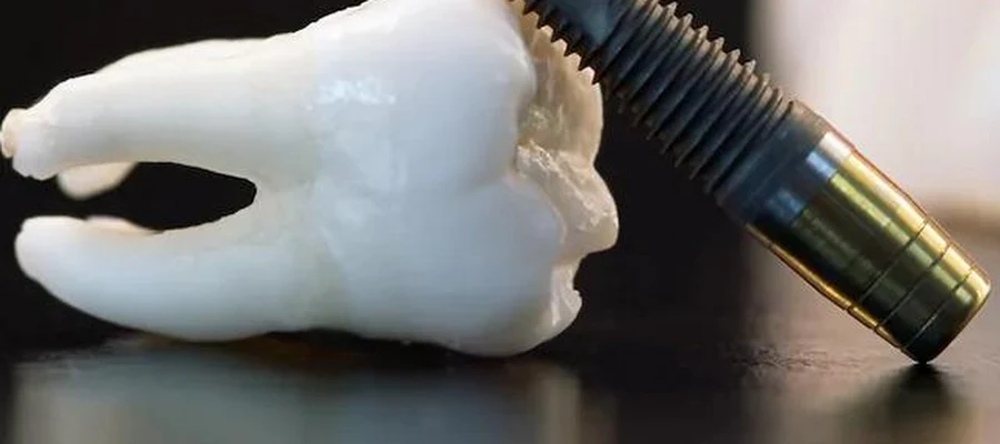 Almeida & Bell Dental Denver - General, Cosmetic, and Implant Dentistry