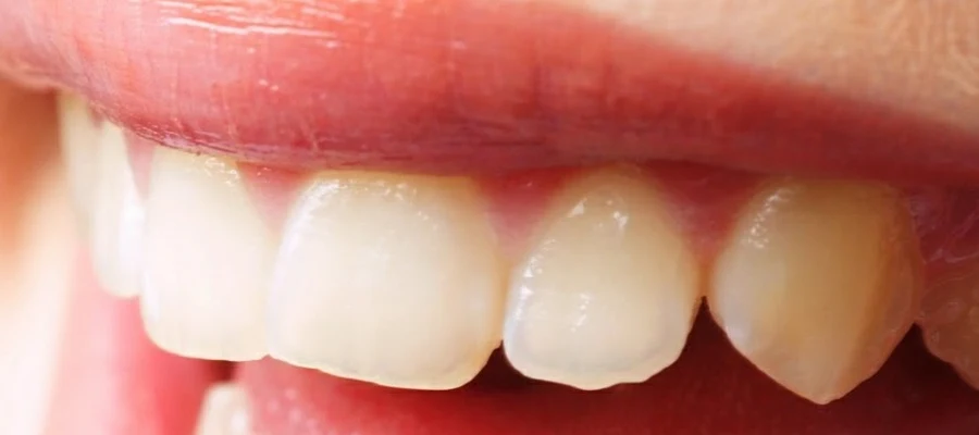 Anderson General Dentistry