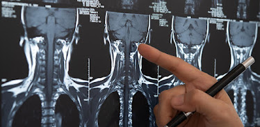 Atlanta Neuro Care: Daniel Tesfaye, MD