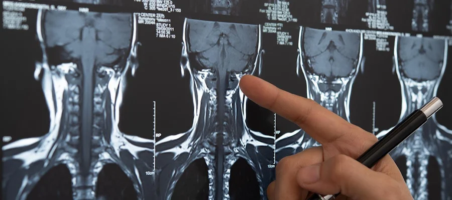Atlanta Neuro Care: Daniel Tesfaye, MD