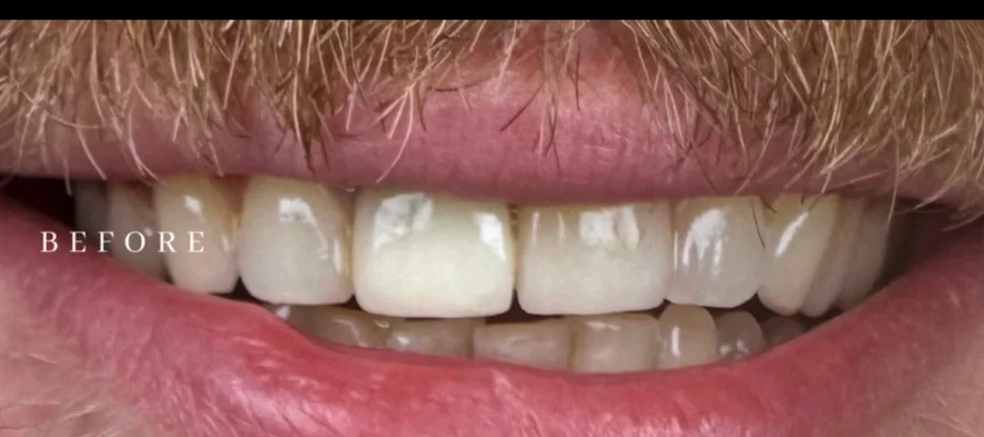 Austin Cosmetic & Implant Dentistry