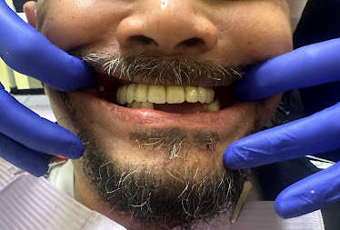 Avid Dental