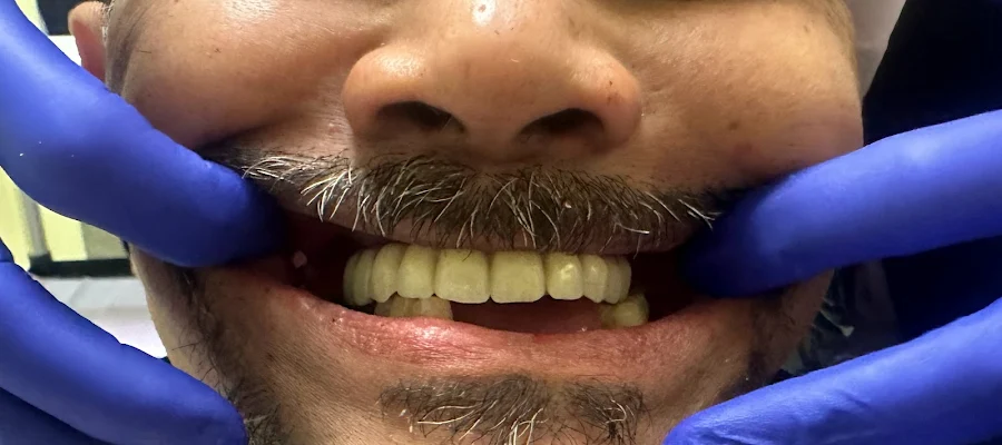 Avid Dental