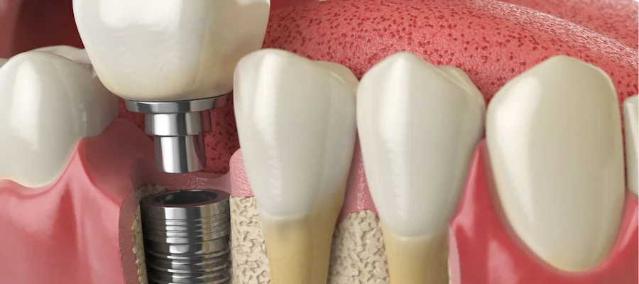 Baltimore City Dental Group