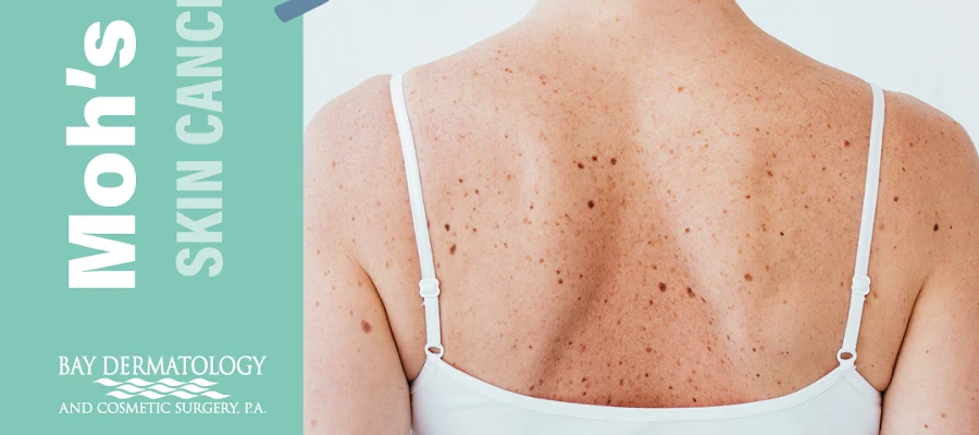 Bay Dermatology
