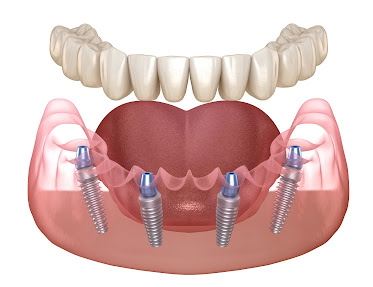Belle Smile Dental