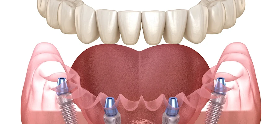 Belle Smile Dental