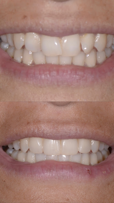 Bertie Dental Office