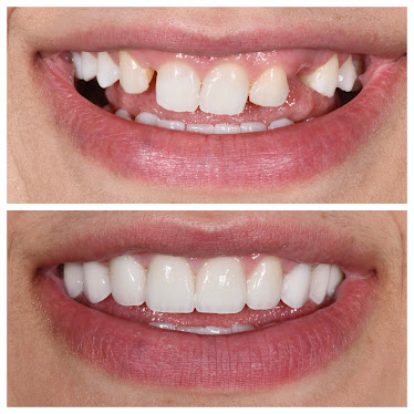 Birmingham Dental Care