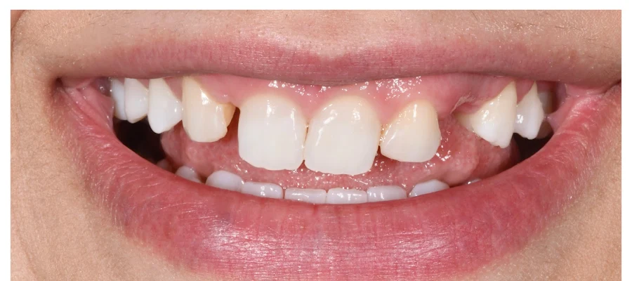 Birmingham Dental Care
