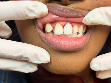 Briar Forest Dental Group