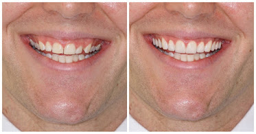 Bright Smile Dentistry- Dr Rassam-Zora