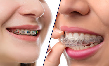 Brightside Orthodontics