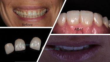 Bucks Dental Health and Esthetics: Hai Qing, DMD, Ph.D., Prosthodontist