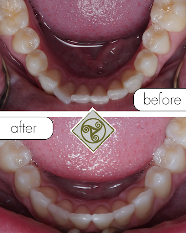 Campbell Dental