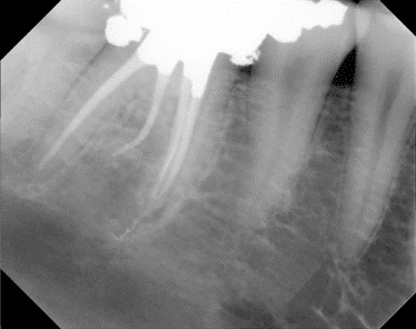 Carson City Endodontics