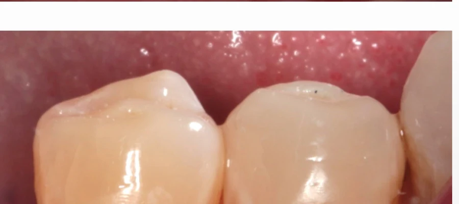 Cen-Tex Dental