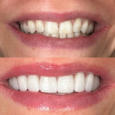 Centerport Cosmetic & Implant Dentistry