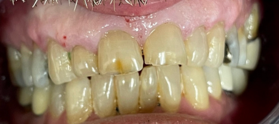 Commack Family Dental