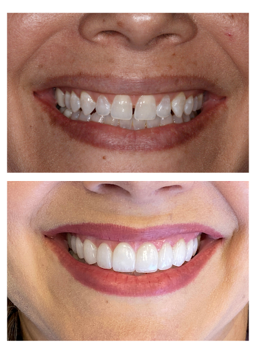 Cosmetic Dentist Honolulu : Wynn H. Okuda DMD Inc