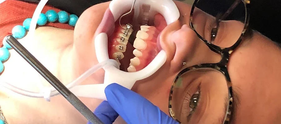 Crawford Orthodontics: Bethany Crawford, DDS