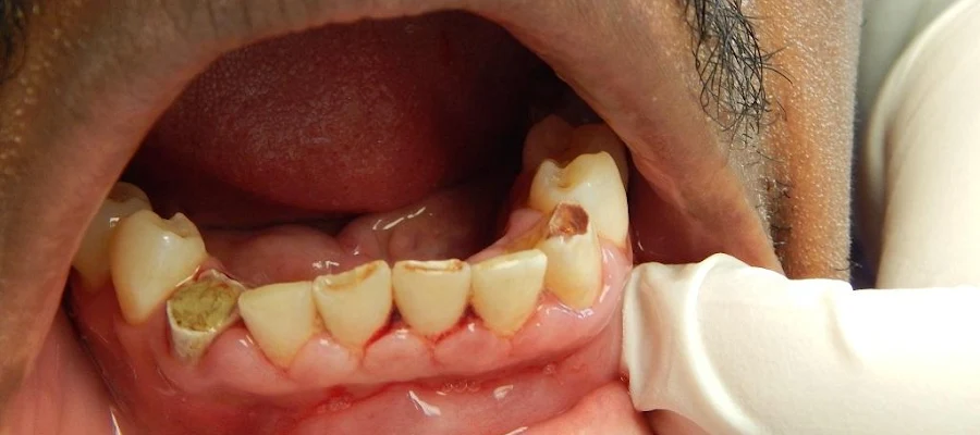 Daniel Rosinsky DDS
