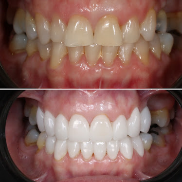 ​Dentist in Park Ridge, NJ - Enhance Dentistry