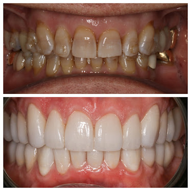 DNTL-Prosthodontist/ Periodontist/ Endodontic Specialists