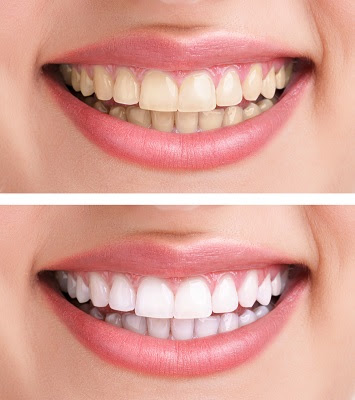 Dr. Christopher Pescatore Restorative & Cosmetic Dentistry