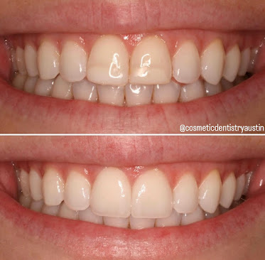 Dr. John Schmid, D.D.S. LVIF - Contemporary Cosmetic Dentistry