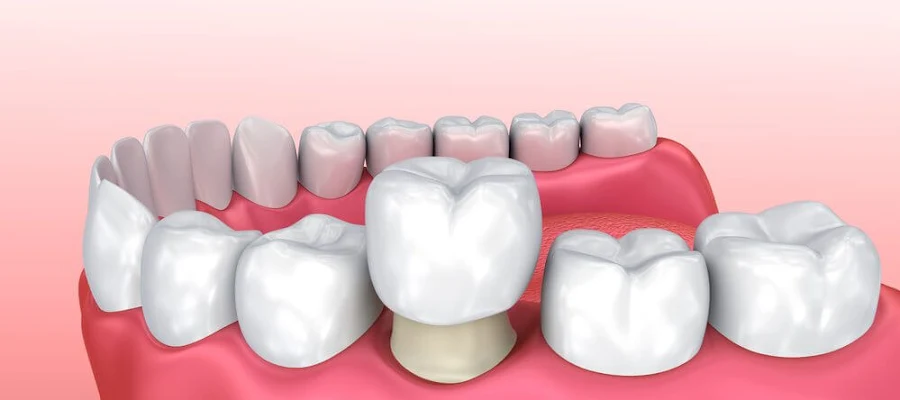 Family Dental Care of Marietta