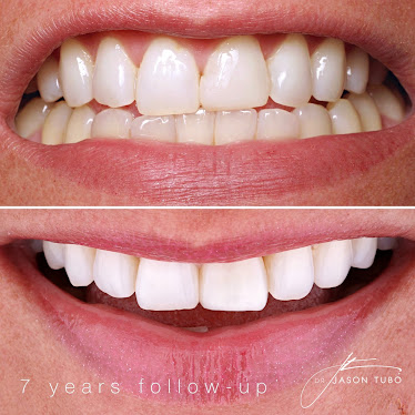 FIXT Dental
